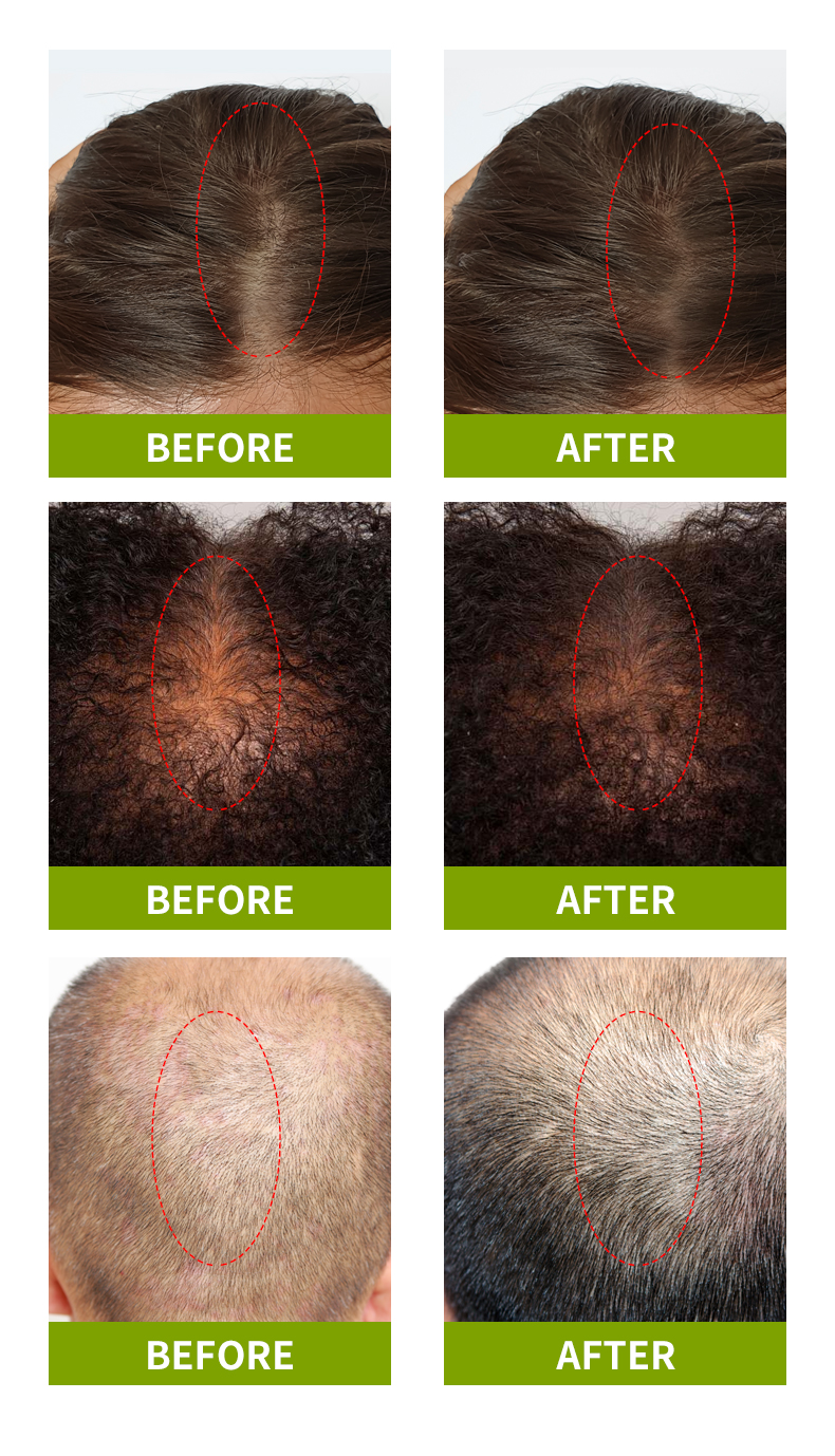 Syulli草本护发油_08