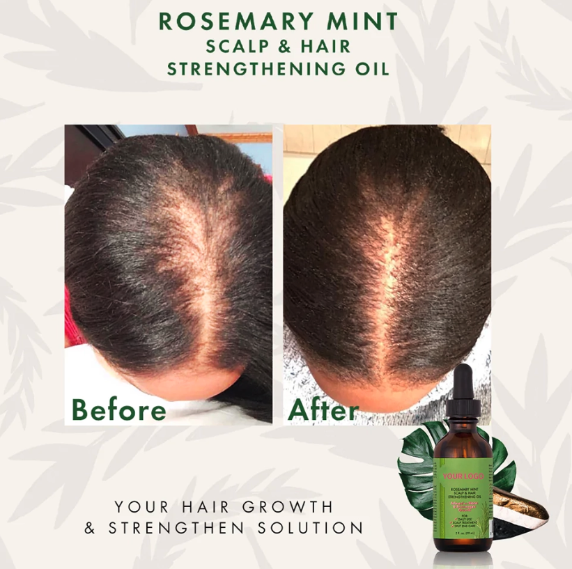 hair growth treatment serum
