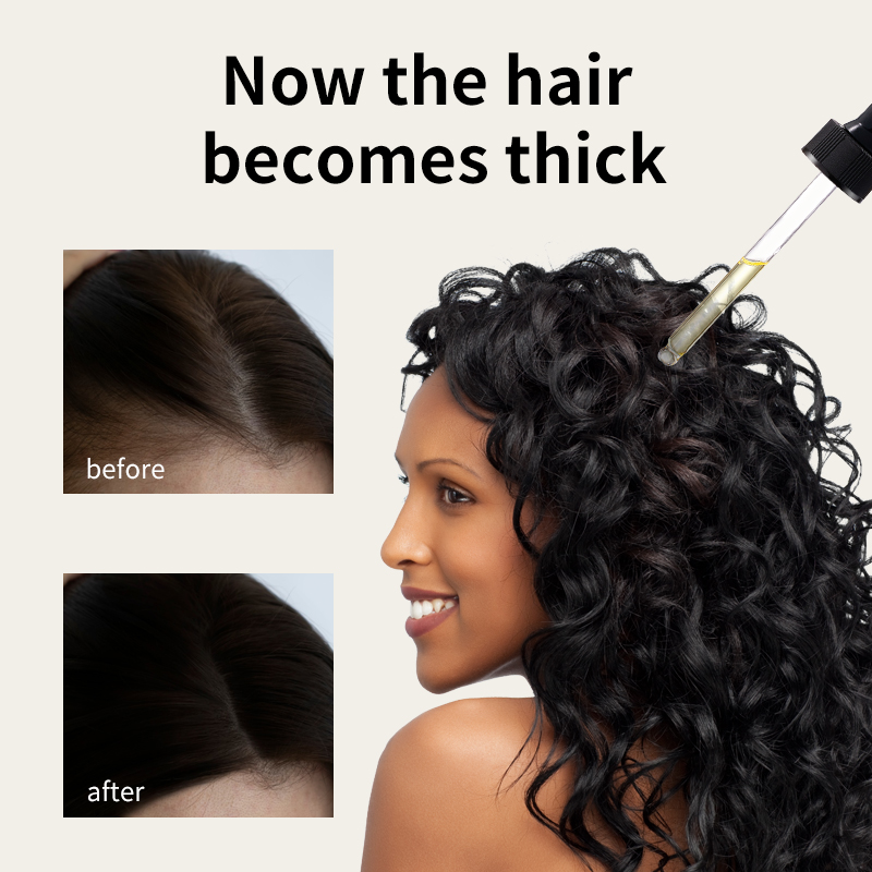 Syulli Hair Growth Oil | Rosemary & Ginger Anti-Hair Loss Oil | Stimulate Follicles