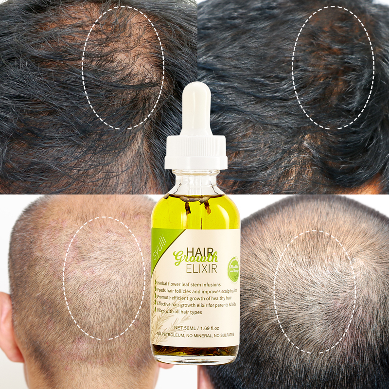 100% Natural Organic Ayurvedic Herbs Black Women Hair Treatment Oil