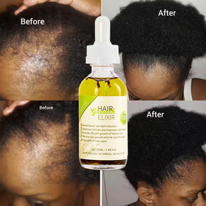 Syulli Herbal Hair Growth Elixir with Rosemary & Peppermint | 8 Plant Extracts | Scalp Treatment | Wholesale & OEM