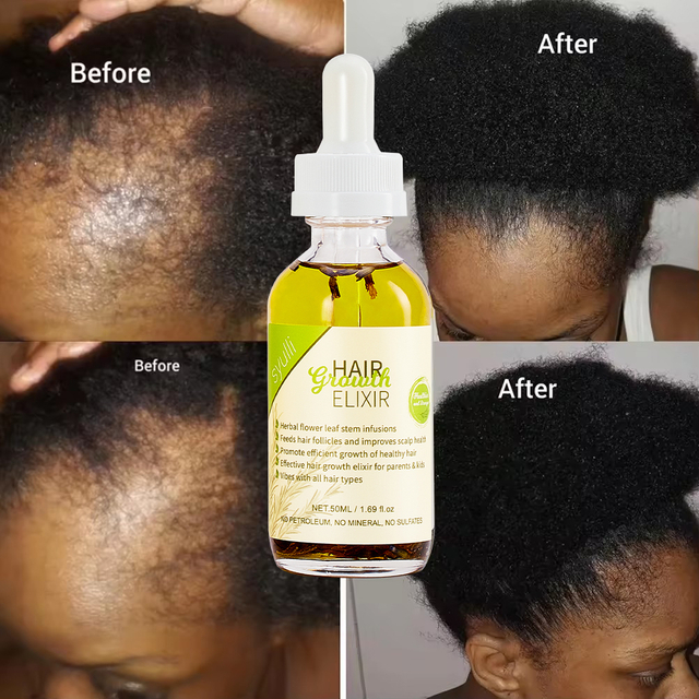 Syulli Herbal Hair Growth Elixir with Rosemary & Peppermint | 8 Plant Extracts | Scalp Treatment | Wholesale & OEM