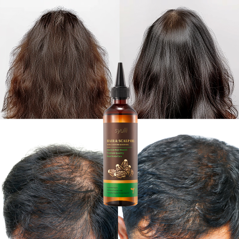 Syulli Hair & Scalp Oil | Grapeseed, Castor, Geranium& Jasmine | Premium Hair Care