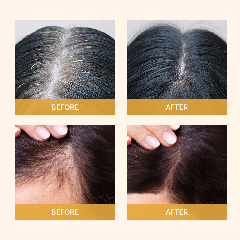 Herbal Hair Growth Serum with Biotin & Ginger