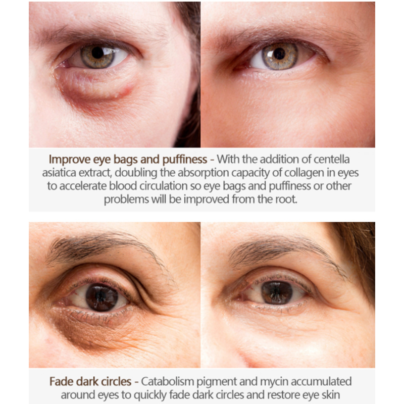 Custom Anti Wrinkle Eye Cream With Applicator (2)