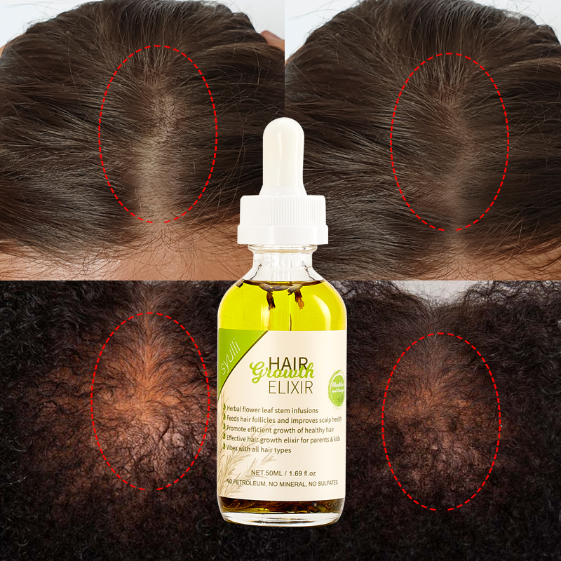 100% Natural Organic Ayurvedic Herbs Black Women Hair Treatment Oil