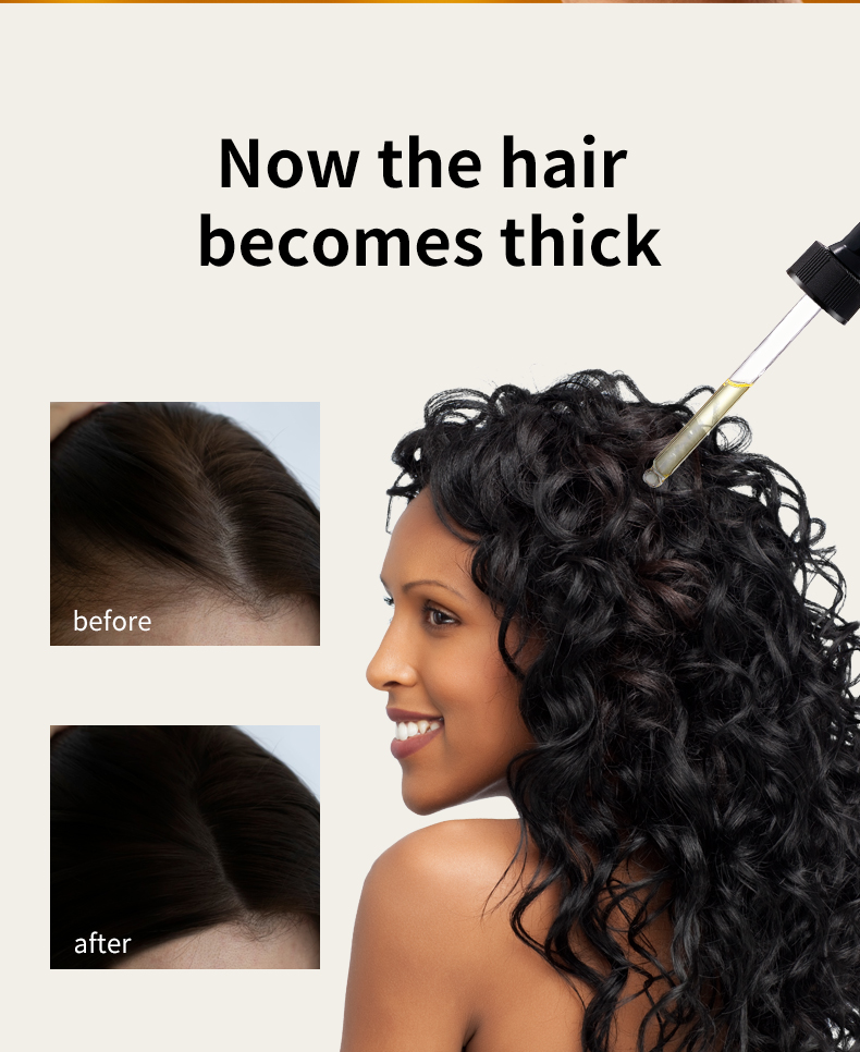 防脱生发油(黄色)-第二版_07